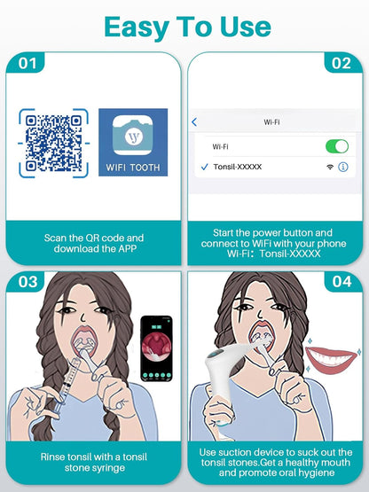 Voraiya Tonsil Stone Remover. Camera, LED Light, 5-Level Suction